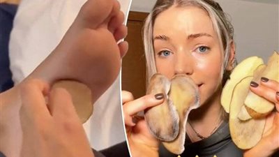 طبيب يكشف صحة التريند الجديد لعلاج نزلات البرد.. البطاطس في الجوارب