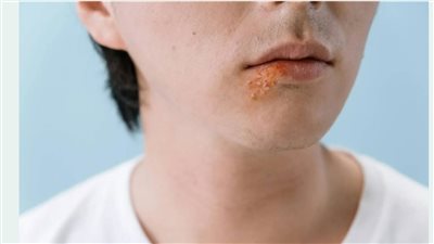 علامات مهمة تُنذر بنقص فيتامين 