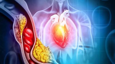  حقائق عن الكوليسترول لا ينبغي تجاهلها