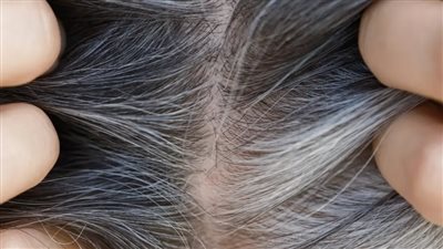 السيطرة على ضغط الدم تقلل خطر الإصابة بالخرف بنسبة 15%