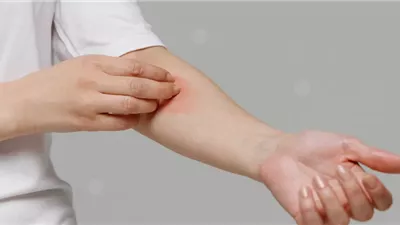 حكة الجلد المستمرة قد تنذرك بمرض قاتل (تفاصيل)