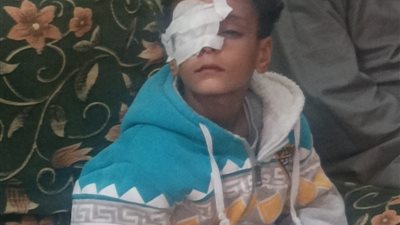 ندب الطب الشرعى لتحديد أسباب وفاة طالب في قـــنا