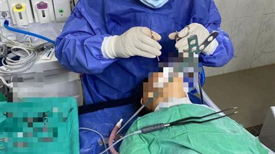 مستشفى جمصة المركزي  تُدخل جراحات الأنف والأذن ضمن منظومة العلاج