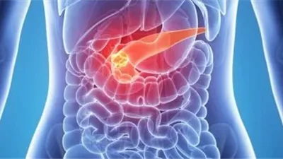 تجنبها.. مواد نتعرض لها يوميًا تتلف وظائف البنكرياس 