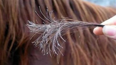طبيب يكشف أسباب تقصف الشعر وأبرز طرق علاجه