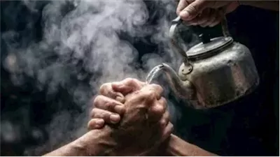 حروق وتلف دائم في الجلد.. تحذير عاجل من 