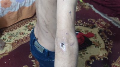 “ضرب وتجويع”.. عائلة طفل بالفيوم تتهم زوجة أبيه بتعذيبه