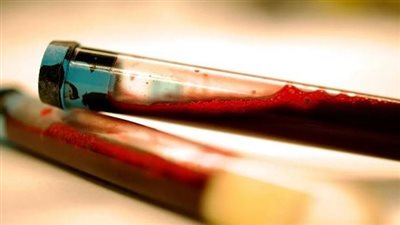 اكتشاف جديد لعلاج «الشلل الرعاش» قبل تلف الدماغ