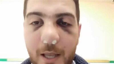 طبيب الباجور