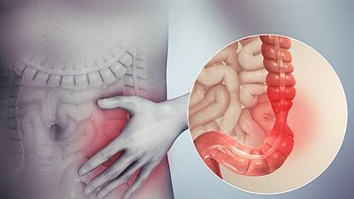 أشهر العادات المسببة للقولون العصبي وطرق علاجه