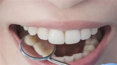 دواء ياباني واعد يقترب من تحقيق حلم إنبات الأسنان