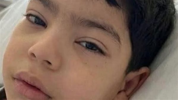 بعد أكثر من ١٩ ساعة.. خروج صغير باسوس من غرفة العمليات عقب جراحة كبرى