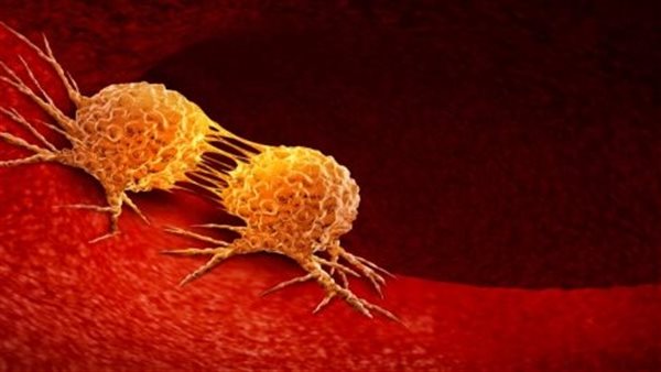 النشاط البدني يقلل خطر الوفاة لدى مرضى السرطان