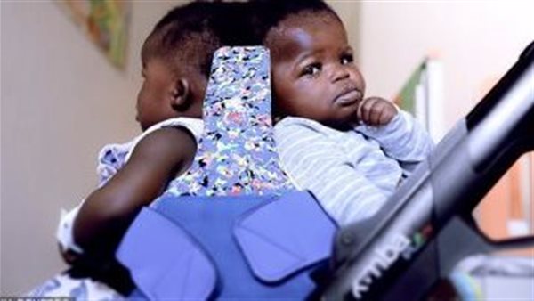 في صيام رمضان التوأمين الملتصقين شخص واحد أم شخصان؟