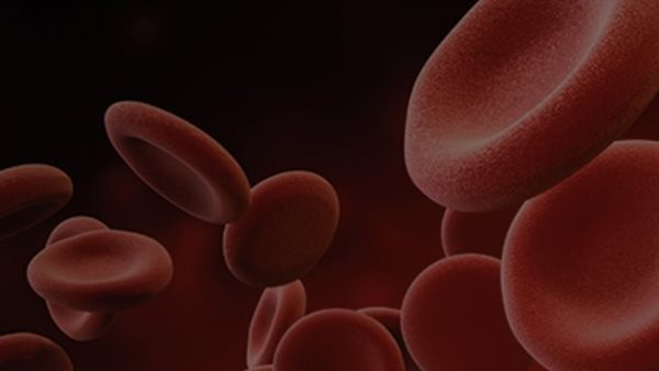 علاج تكور كريات الدم الحمراء الوراثي