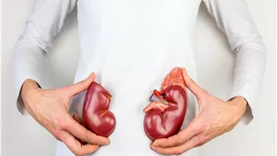تجنبها.. أطعمة ضارة بصحة الكلى
