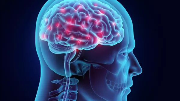 نتائج صادمة.. مكان السكن يؤثر على فرص التعافي بعد السكتة الدماغية