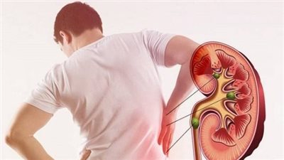 عادات يومية تحمي الكلى.. خطوات بسيطة لتجنب مشكلات صحية خطيرة