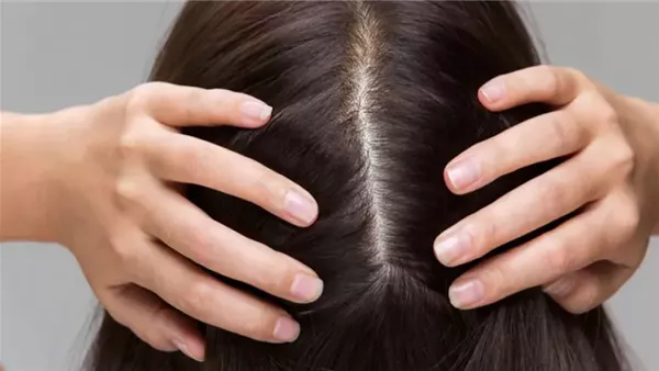فروة رأس صحية.. أفضل طرق التنظيف للحفاظ على جمال شعرك