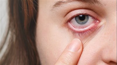 تعرف على مدى فاعلية عملية علاج جفاف العين