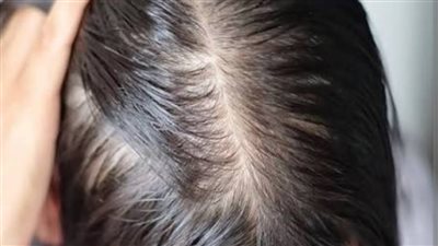 أفضل زيوت لعلاج الشعر الخفيف