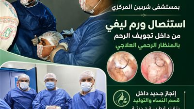 استئصال ورم ليفي من داخل الرحم باستخدام المنظار الرحم بمستشفى شربين