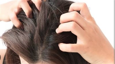 حكة فروة الرأس المزعجة.. أسباب متعددة وحلول فعّالة