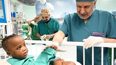 ‏بدء عملية فصل التوأم الملتصق التنزاني 