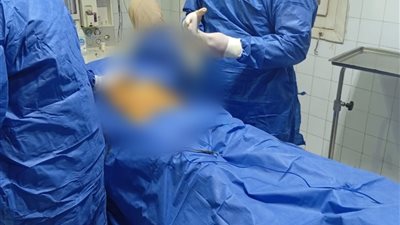 إنجاز 17 تدخلاً جراحياً دقيقاً في العظام والجراحة العامة بالمنيا