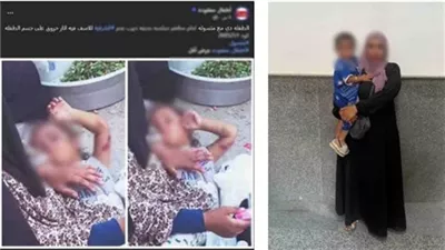 ضبط سيدة لاتهامها باستغلال ابنتها المصابة بحروق في أعمال التسول بالشرقية 