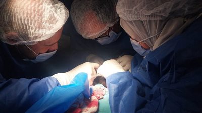 7 ساعات لإنقاذ وجه شاب بجراحة دقيقة في مستشفى بلبيس المركزي