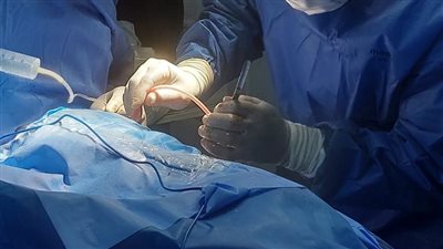 إجراء أول جراحتين للمخ والأعصاب بمستشفى أبوكبير المركزي لإنقاذ مصابين في حوادث سير