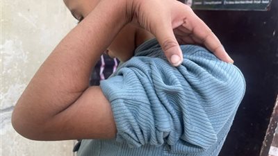 مستشفى الفكرية المركزي: طفل يستعيد حركته بفضل التكامل الطبي
