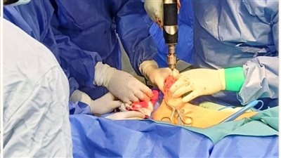 صحة الشرقية تحقق طفرة جراحية بإجراء 44 عملية كبرى لأول مرة