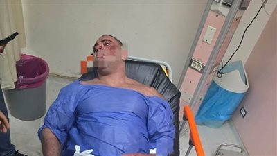 المشدد 7 سنوات للمتهم بالاعتداء على مدير جولدز جيم الشيخ زايد
