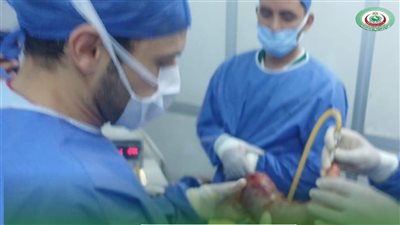 أول تكميم معدة بالمنظار في مشتول السوق المركزي