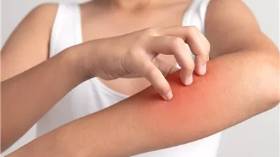 علماء يبتكرون مادة جديدة لعلاج الجلد