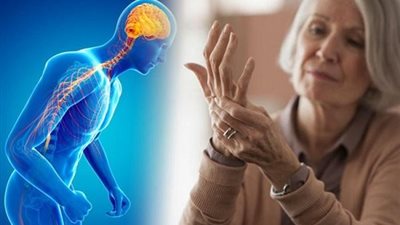 علامات خفية تظهر قبل الإصابة بمرض باركنسون.. تعرف عليها 