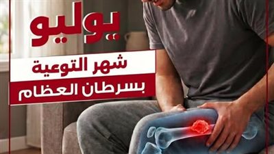نقابة الأطباء تؤكد أهمية الاكتشاف المبكر لسرطان العظام وعدم تجاهل الأعراض