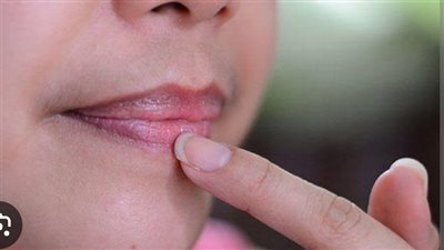 وصفات طبيعية لعلاج اسمرار الشفاه.. خطوات بسيطة لاستعادة اللون الوردي والنضارة