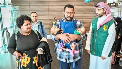 عملية لفصل التوأم الملتصق الفيجي 