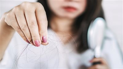 تساقط الشعر.. أسباب شائعة وراء فقدان كثافته دون أن تنتبه