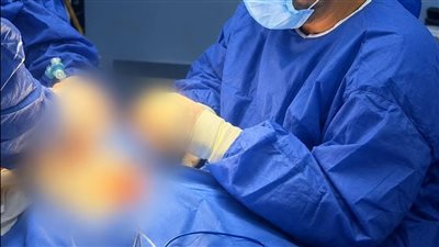 احراء عملية دقيقة في القلب  لطفله عمرها  36  بمستشفى ابوكبير المركزي 