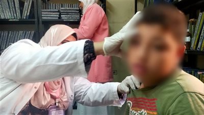 تقديم الخدمة لـ 1818 مريضًا وتحيل 5 حالات لإجراء عمليات بالشرقية 