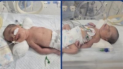وُلدا أحياء بعد وفاة الأم.. ريان ورحيم توأم سوهاج يلحقان بوالدتهما بعد أسبوعين (تفاصيل)