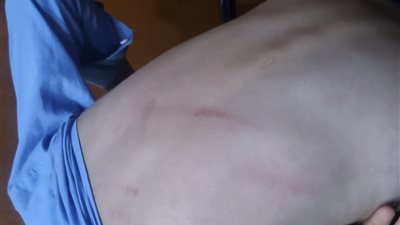 «ضربته بالخرزانة».. ولي أمر يحرر محضرًا ضد معلمة بالمحمودية بتهمة التعدي على نجله داخل المدرسة