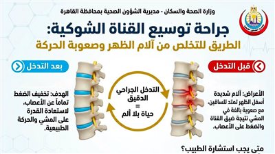 إنقاذ مريض من آلام الظهر وصعوبة الحركة بعد جراحة لتوسيع القناة الشوكية 